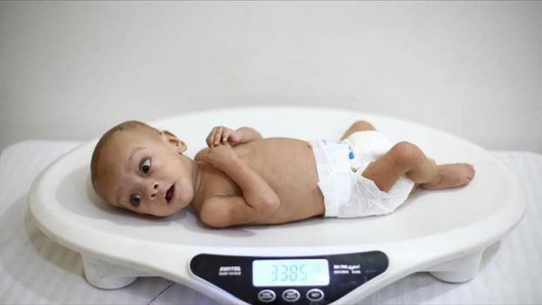 Daun Kelor untuk Mencegah Stunting pada Balita [Waktu Baca 2 Menit]