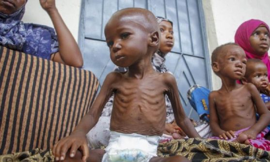 Cegah Gizi Buruk Kronis Dengan Ini! [Waktu Baca 3 Menit]